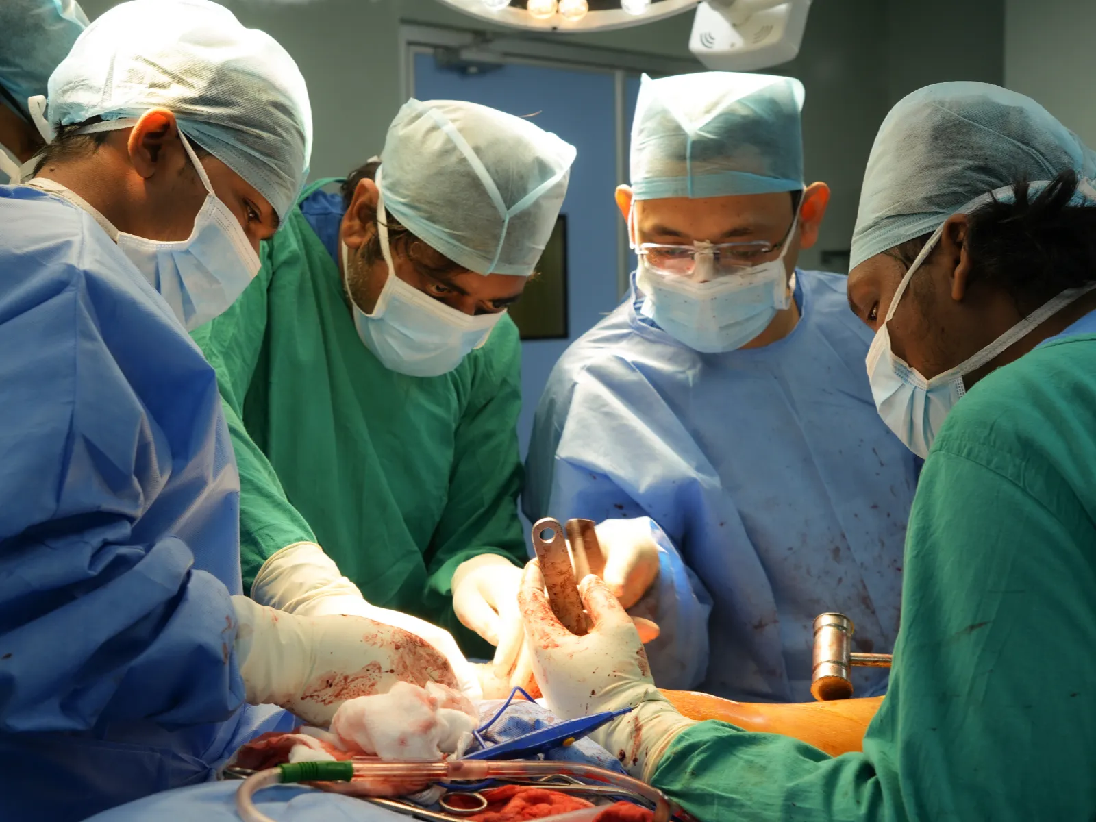 Total Hip Replacement